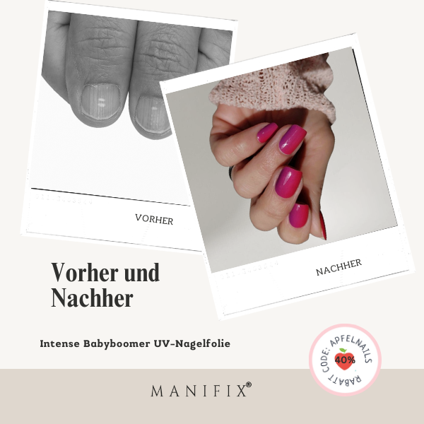 Fingernägel mit Rillen? 3 Gründe, warum Nagellack scheitert & MANIFIX gewinnt