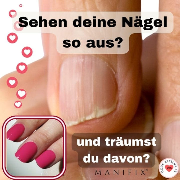 Beautiful Nails Despite Ridges: Discover the Benefits of UV Wraps!
