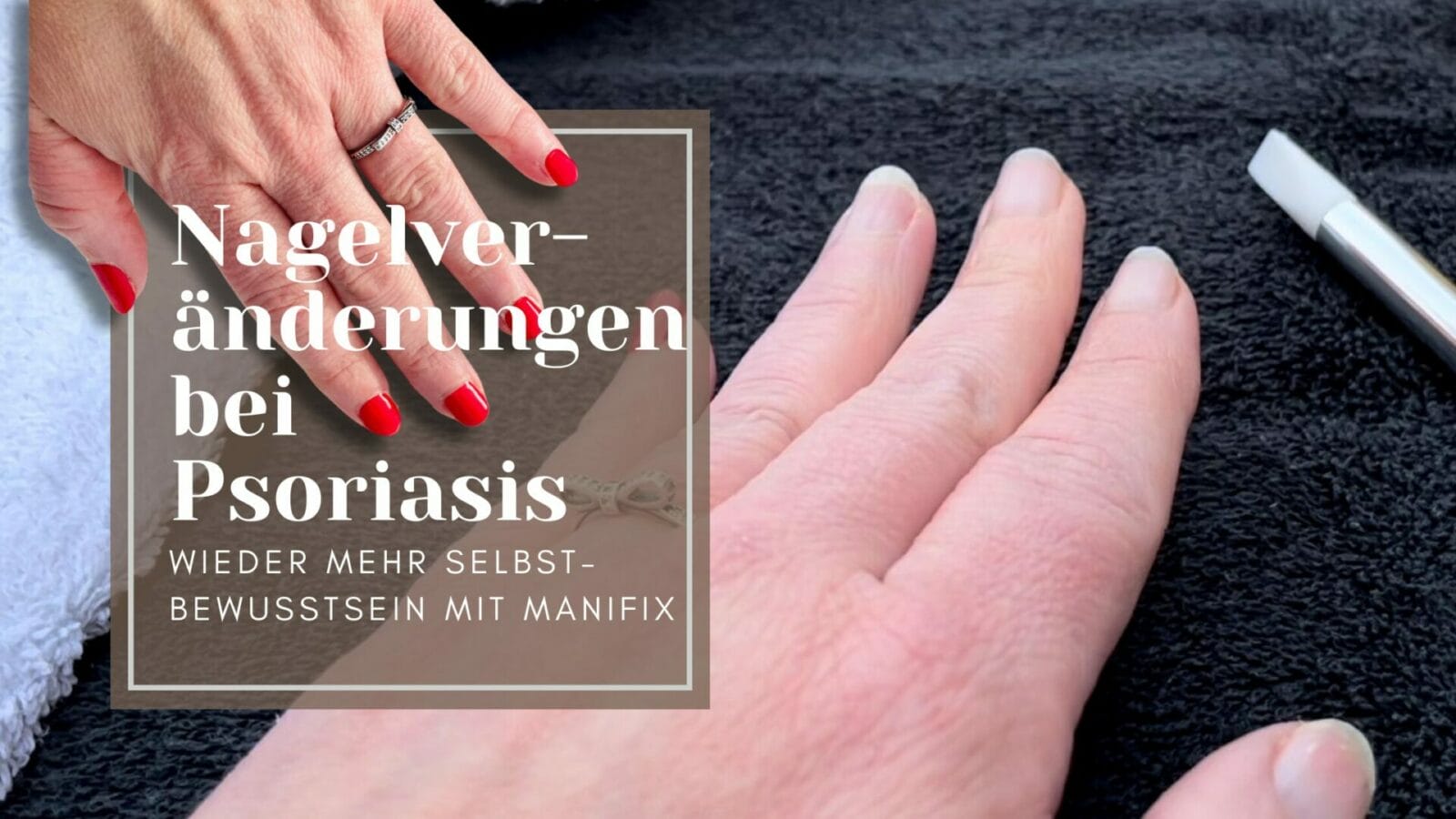 Psoriasis Nägel versus schöne Hand mit Lösung