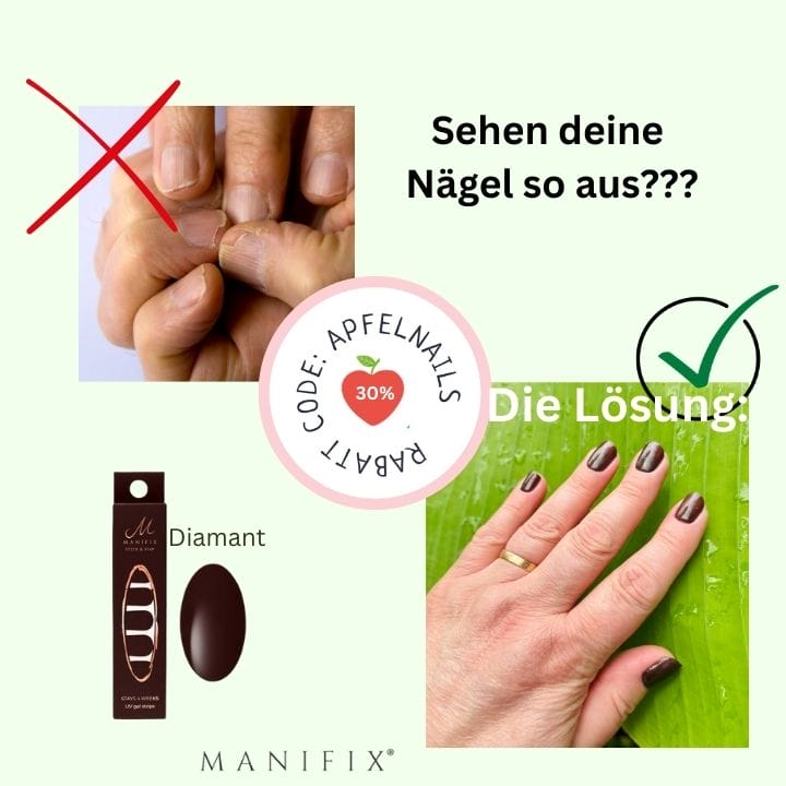 eingerissene Fingernägel  und Rettung mit UV-Nagelfolien