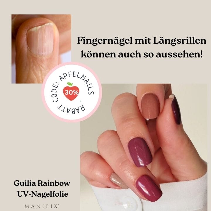 Fingernägel mit Längsrillen Rettung mit UV-Nagelfolien