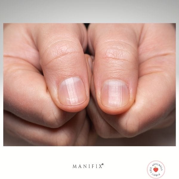 Längsrillen Fingernägel & UV-Nagelfolien – Der Weg zu ebenmäßigen Nägeln