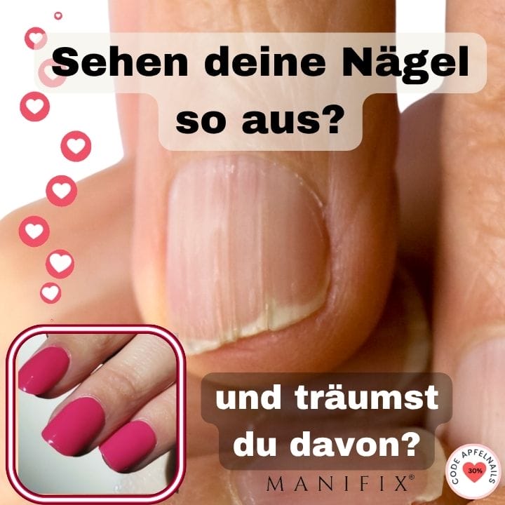 Schöne Nägel trotz Rillen: Entdecke die Vorteile von UV-Folien!