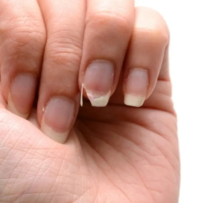 Fingernägel brechen Mangel: Vermeide diese fatalen Fehler und rette deine Nägel
